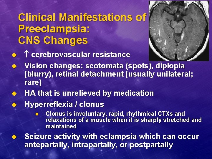 Clinical Manifestations of Preeclampsia: CNS Changes u u cerebrovascular resistance Vision changes: scotomata (spots),