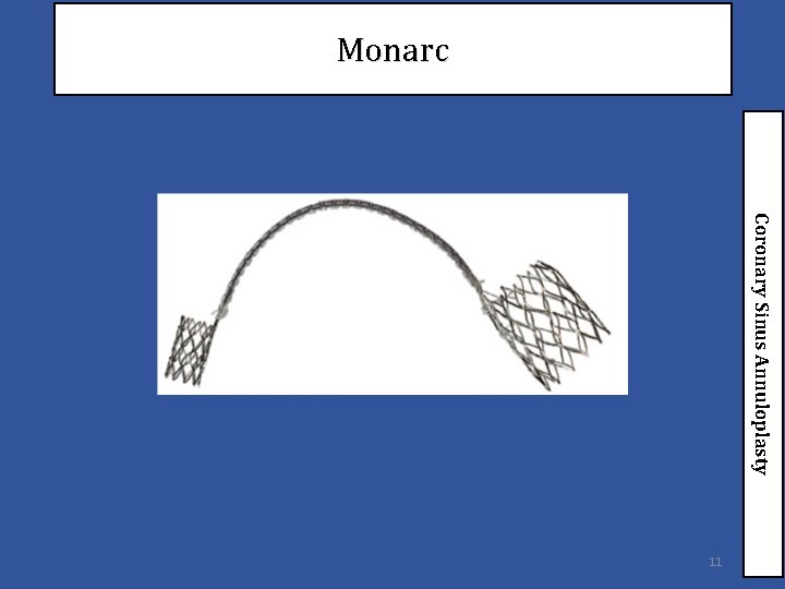 Monarc Coronary Sinus Annuloplasty 11 