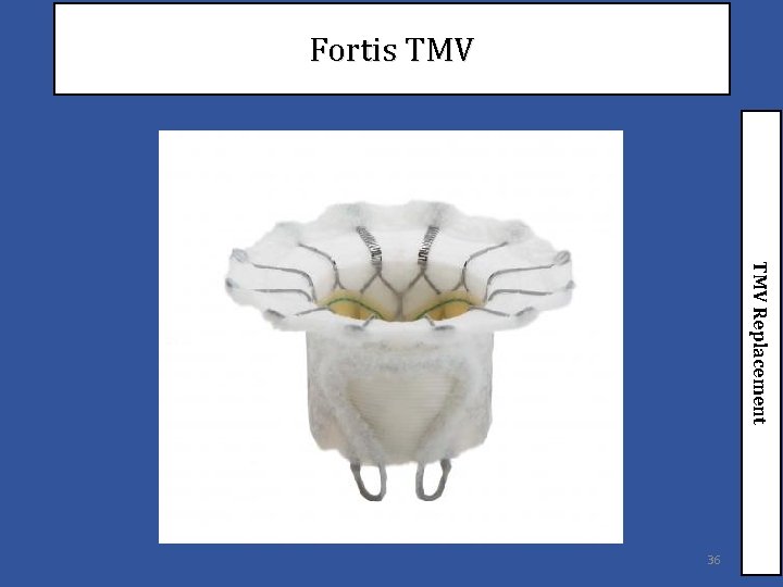 Fortis TMV Replacement 36 