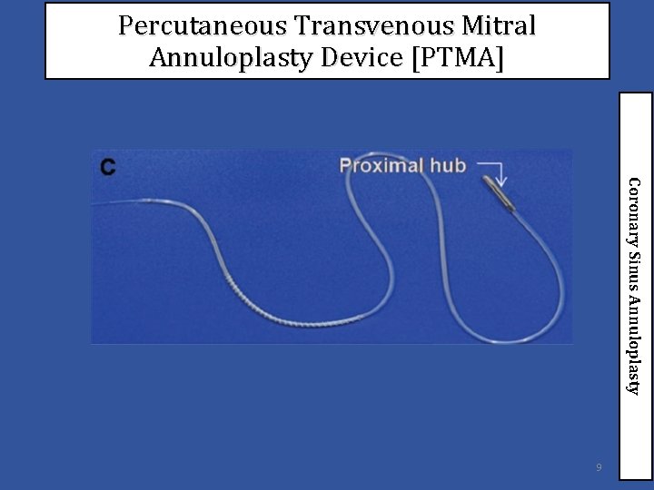 Percutaneous Transvenous Mitral Annuloplasty Device [PTMA] Coronary Sinus Annuloplasty 9 