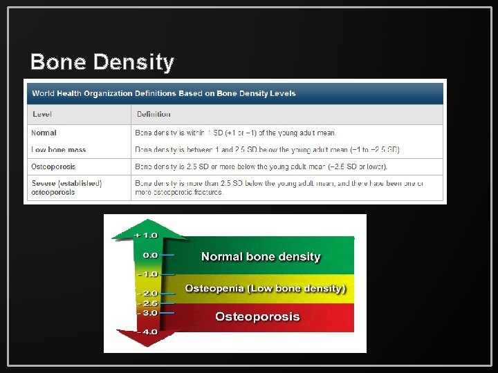 Bone Density 