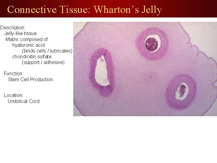 Connective Tissue: Wharton’s Jelly Description: Jelly-like tissue Matrix composed of: hyaluronic acid (binds cells
