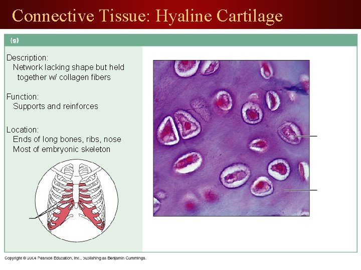 Connective Tissue: Hyaline Cartilage Description: Network lacking shape but held together w/ collagen fibers