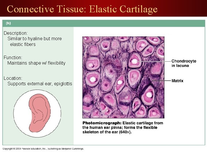 Connective Tissue: Elastic Cartilage Description: Similar to hyaline but more elastic fibers Function: Maintains