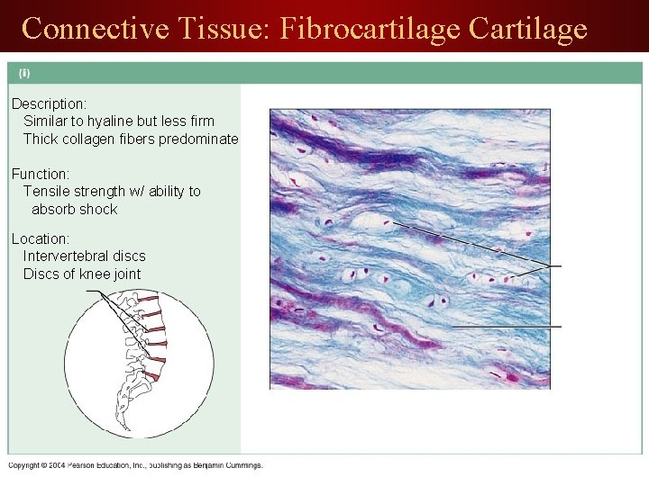 Connective Tissue: Fibrocartilage Cartilage Description: Similar to hyaline but less firm Thick collagen fibers