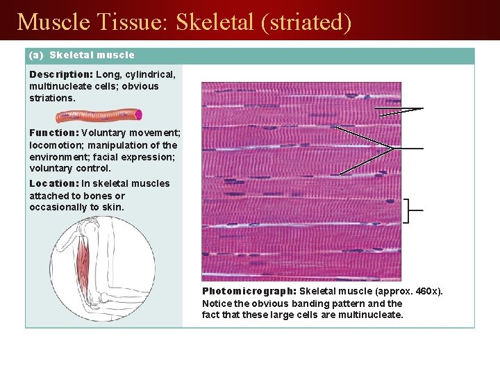 Muscle Tissue: Skeletal (striated) (a) Skeletal muscle Description: Long, cylindrical, multinucleate cells; obvious striations.