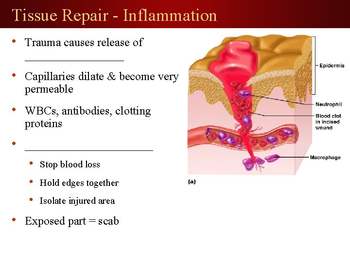 Tissue Repair - Inflammation • Trauma causes release of _________ • Capillaries dilate &
