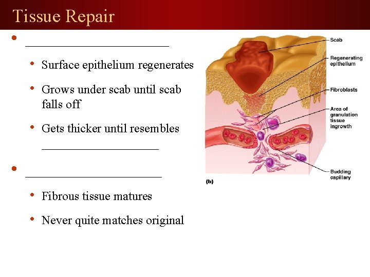 Tissue Repair • __________ • • Surface epithelium regenerates • Grows under scab until