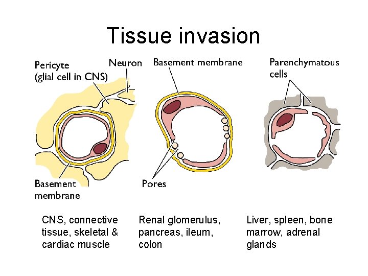 Tissue invasion CNS, connective tissue, skeletal & cardiac muscle Renal glomerulus, pancreas, ileum, colon