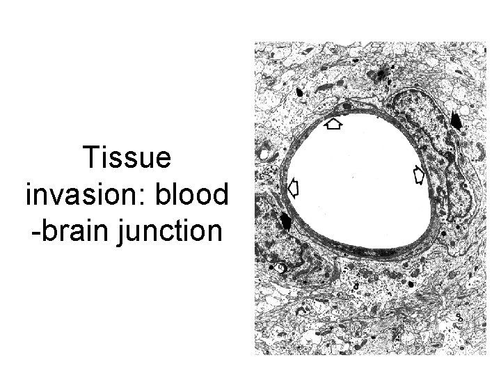 Tissue invasion: blood -brain junction 