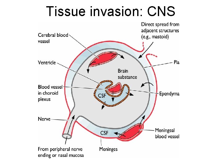Tissue invasion: CNS 