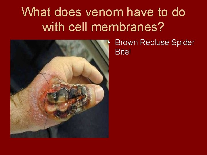 What does venom have to do with cell membranes? • Brown Recluse Spider Bite!