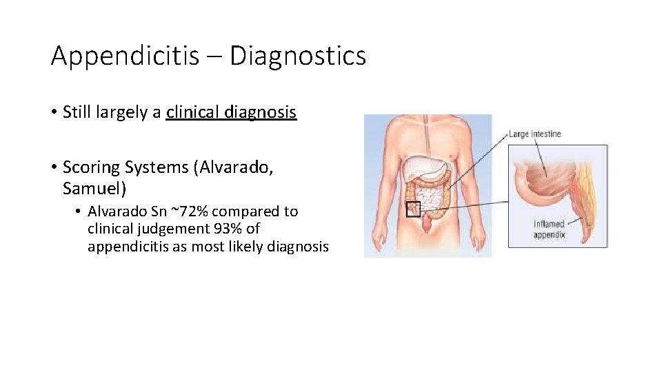 Appendicitis – Diagnostics • Still largely a clinical diagnosis • Scoring Systems (Alvarado, Samuel)