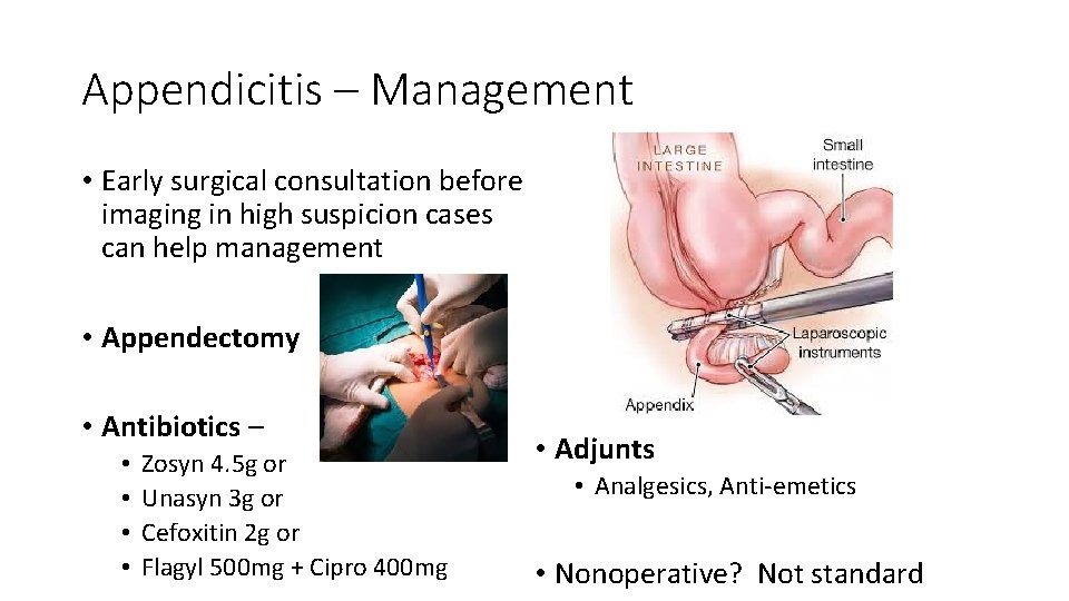 Appendicitis – Management • Early surgical consultation before imaging in high suspicion cases can