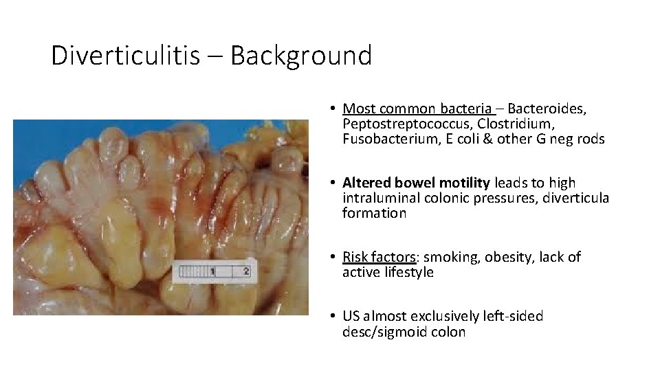 Diverticulitis – Background • Most common bacteria – Bacteroides, Peptostreptococcus, Clostridium, Fusobacterium, E coli