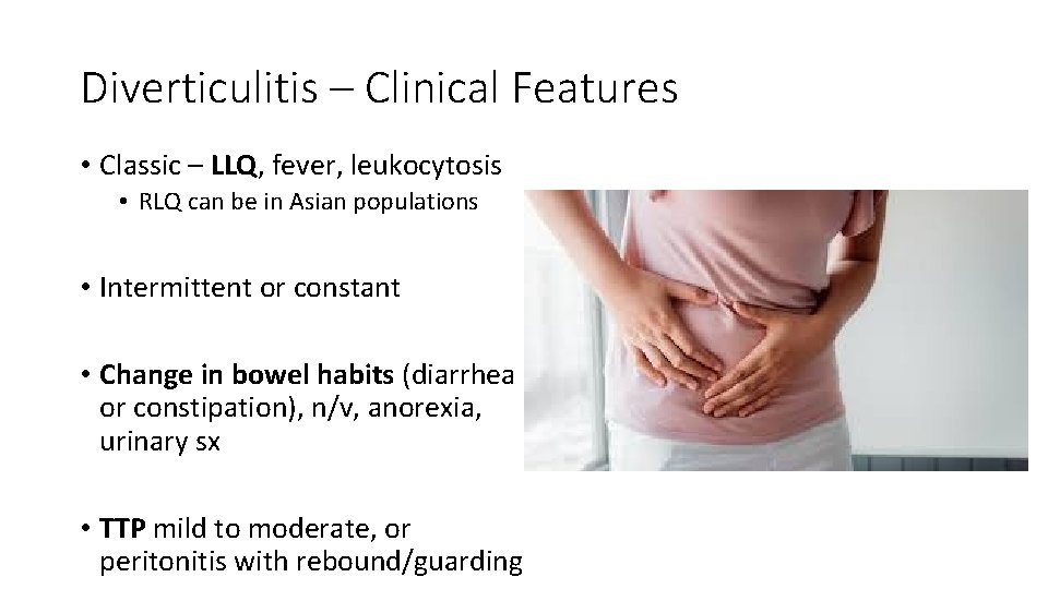 Diverticulitis – Clinical Features • Classic – LLQ, fever, leukocytosis • RLQ can be