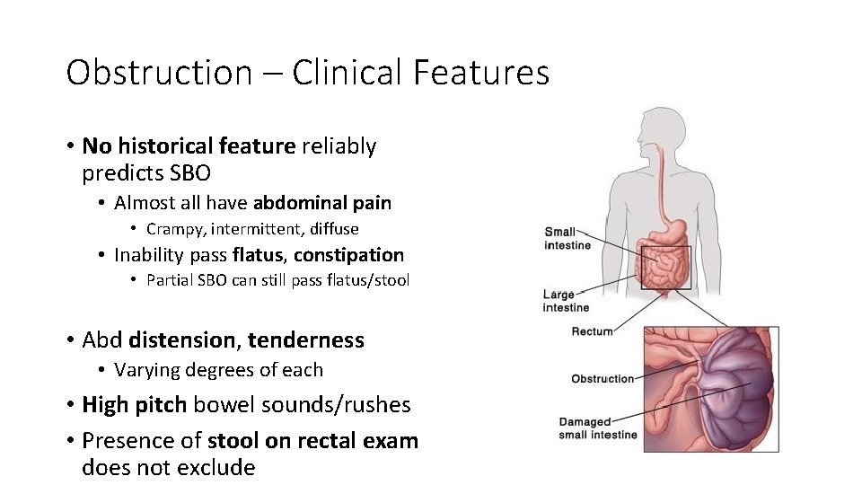 Obstruction – Clinical Features • No historical feature reliably predicts SBO • Almost all