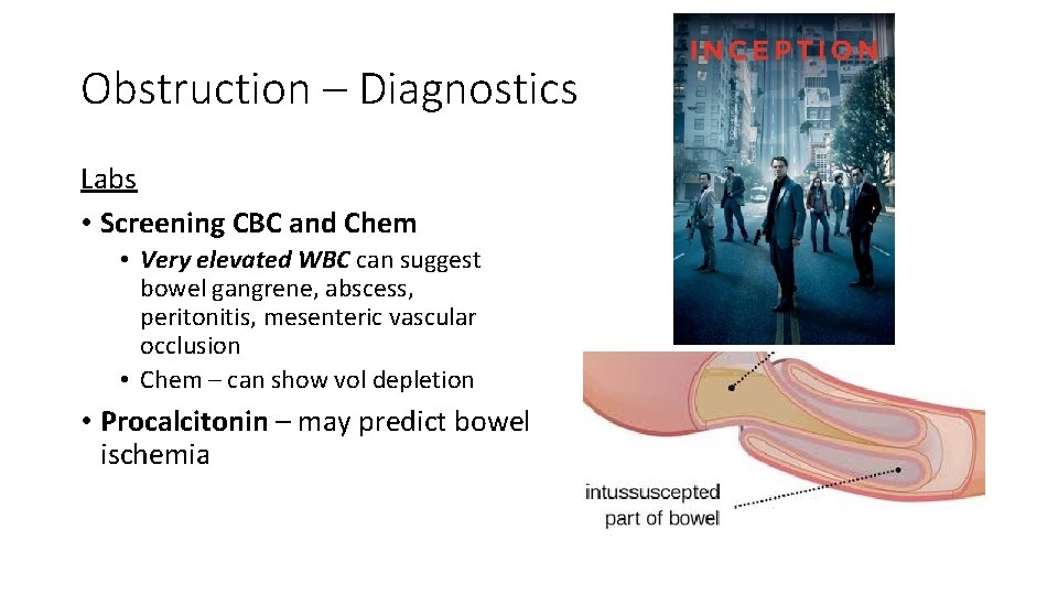 Obstruction – Diagnostics Labs • Screening CBC and Chem • Very elevated WBC can