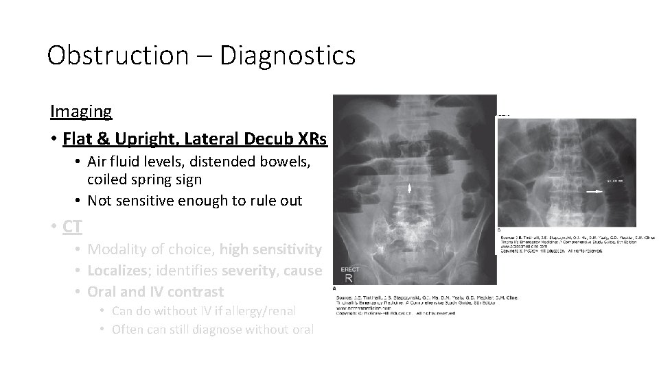 Obstruction – Diagnostics Imaging • Flat & Upright, Lateral Decub XRs • Air fluid