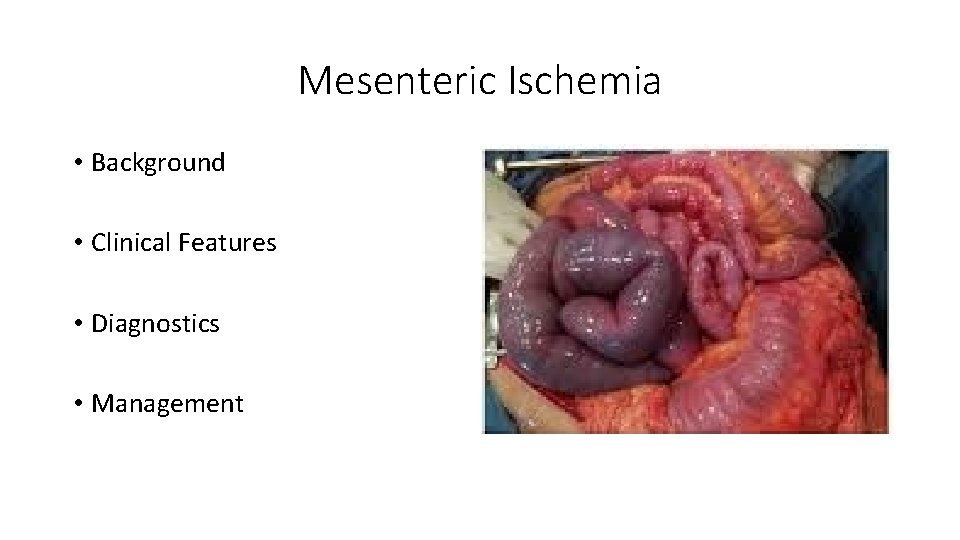 Mesenteric Ischemia • Background • Clinical Features • Diagnostics • Management 