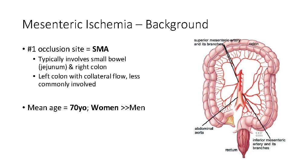 Mesenteric Ischemia – Background • #1 occlusion site = SMA • Typically involves small