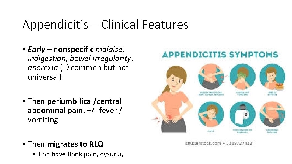 Appendicitis – Clinical Features • Early – nonspecific malaise, indigestion, bowel irregularity, anorexia (