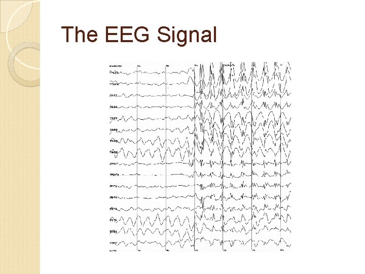 The EEG Signal 