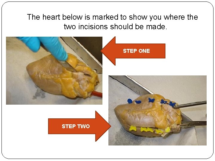 The heart below is marked to show you where the two incisions should be