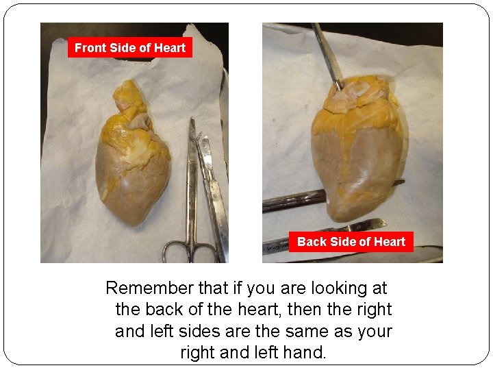 Front Side of Heart Back Side of Heart Remember that if you are looking