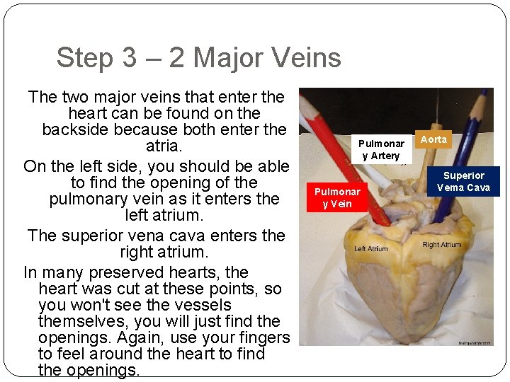 Step 3 – 2 Major Veins The two major veins that enter the heart