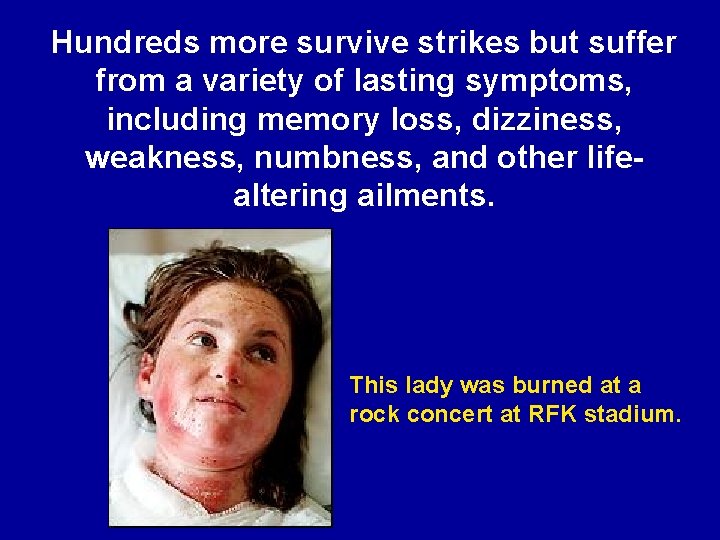 Hundreds more survive strikes but suffer from a variety of lasting symptoms, including memory