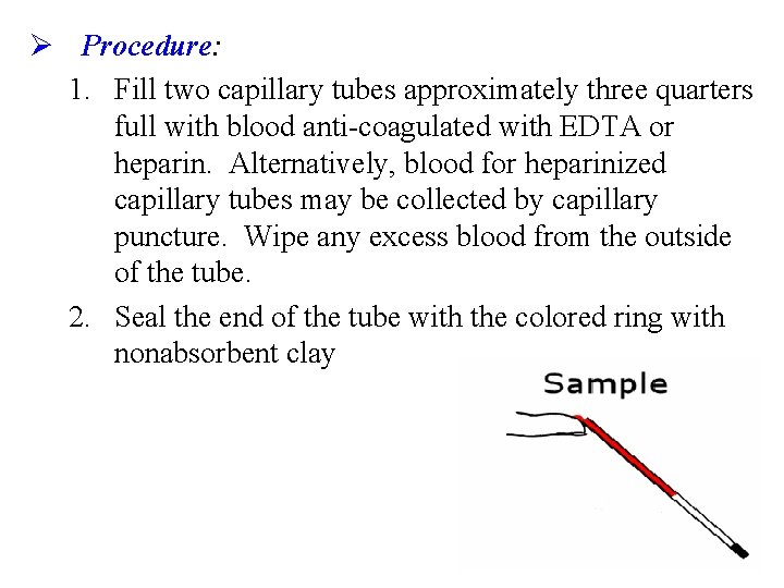 Ø Procedure: 1. Fill two capillary tubes approximately three quarters full with blood anti-coagulated