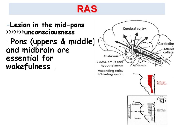 RAS -Lesion in the mid-pons >>>>>>>unconsciousness -Pons (uppers & middle) and midbrain are essential
