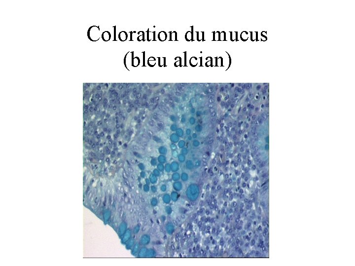 Coloration du mucus (bleu alcian) 