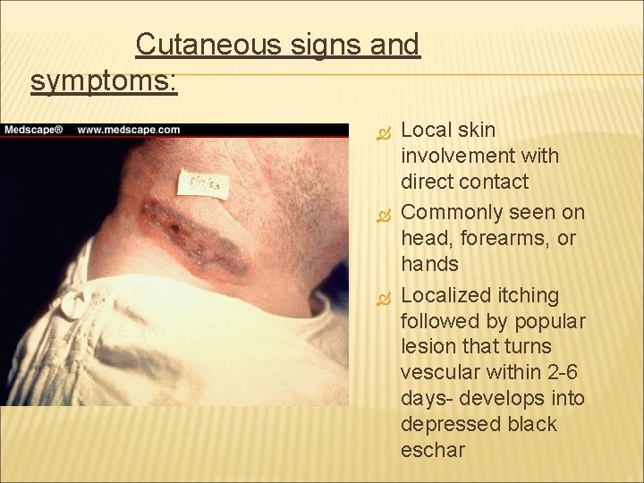Cutaneous signs and symptoms: Local skin involvement with direct contact Commonly seen on head,