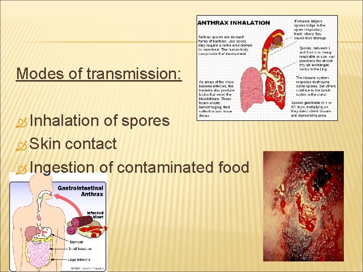 Modes of transmission: Inhalation of spores Skin contact Ingestion of contaminated food 