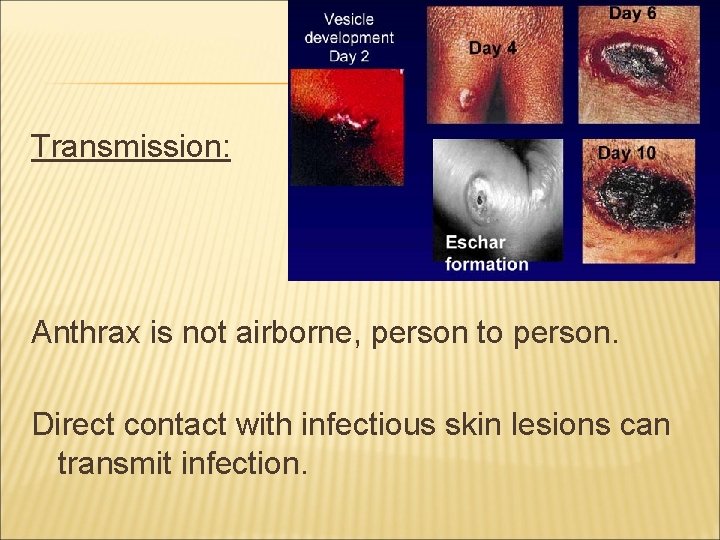 Transmission: Anthrax is not airborne, person to person. Direct contact with infectious skin lesions
