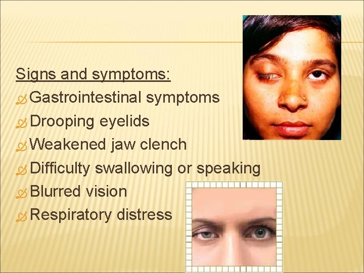 Signs and symptoms: Gastrointestinal symptoms Drooping eyelids Weakened jaw clench Difficulty swallowing or speaking