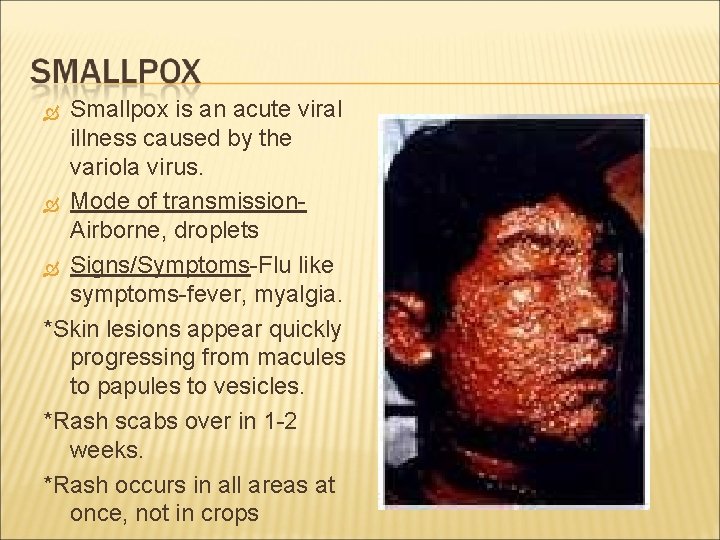Smallpox is an acute viral illness caused by the variola virus. Mode of transmission.