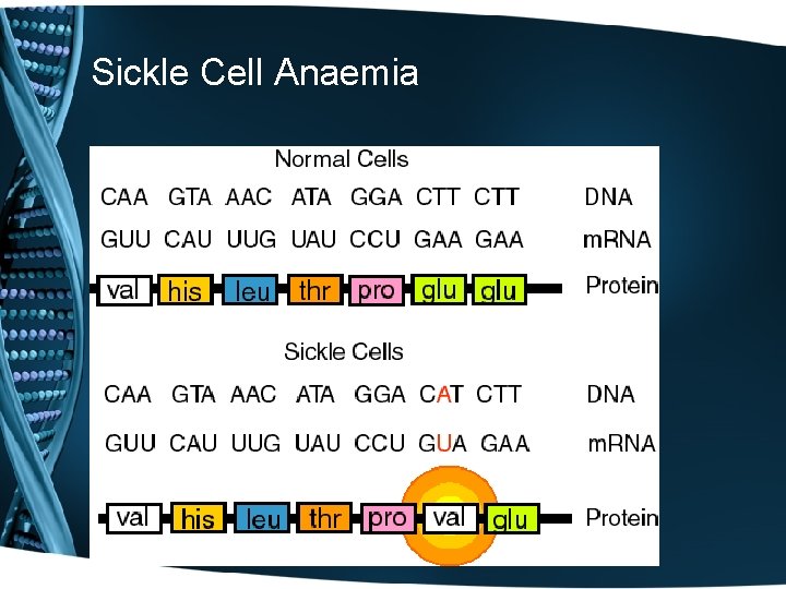 Sickle Cell Anaemia 