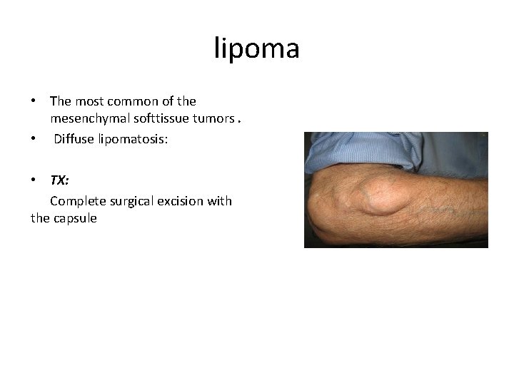 lipoma • The most common of the mesenchymal softtissue tumors. • Diffuse lipomatosis: •