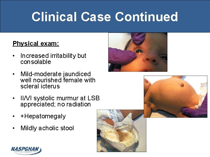 Clinical Case Continued Physical exam: • Increased irritability but consolable • Mild-moderate jaundiced well