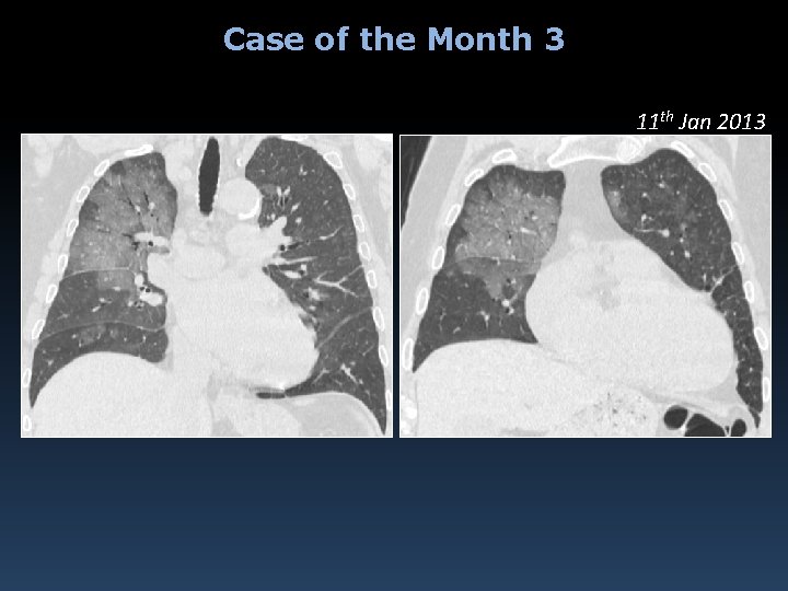 Case of the Month 3 11 th Jan 2013 