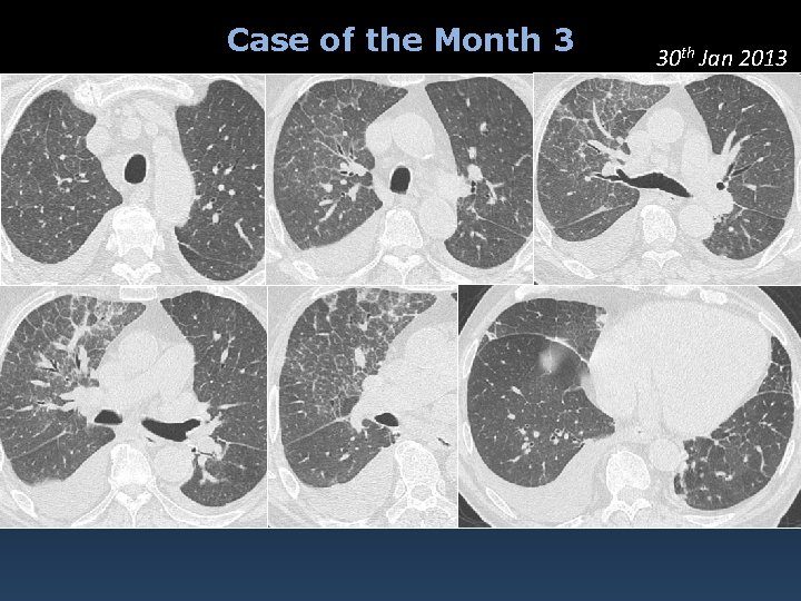 Case of the Month 3 30 th Jan 2013 