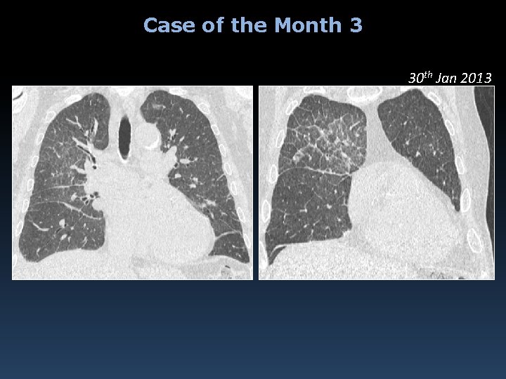 Case of the Month 3 30 th Jan 2013 