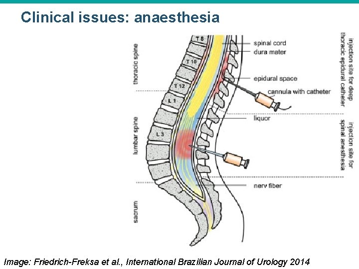 Clinical issues: anaesthesia © 2015 Pearson Education, Inc. Image: Friedrich-Freksa et al. , International