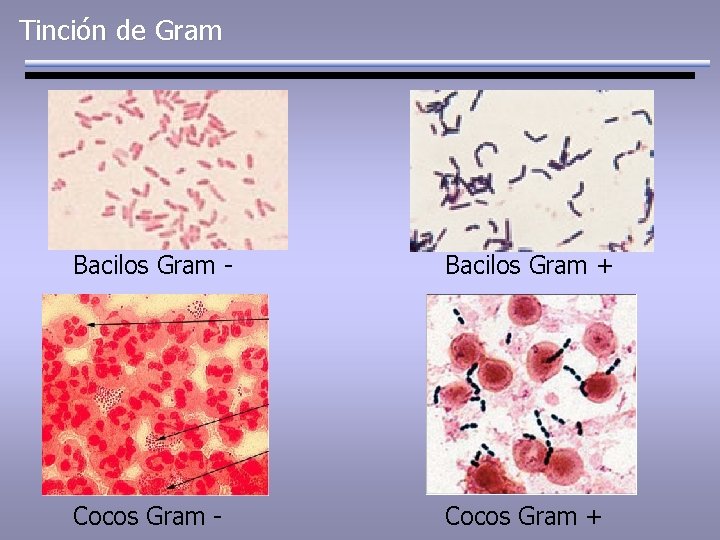 Tinción de Gram Bacilos Gram - Bacilos Gram + Cocos Gram - Cocos Gram