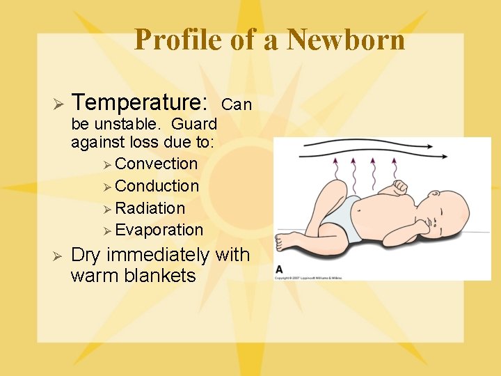 Profile of a Newborn Ø Temperature: Can be unstable. Guard against loss due to: