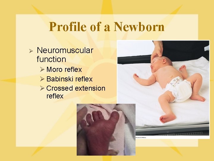 Profile of a Newborn Ø Neuromuscular function Ø Moro reflex Ø Babinski reflex Ø