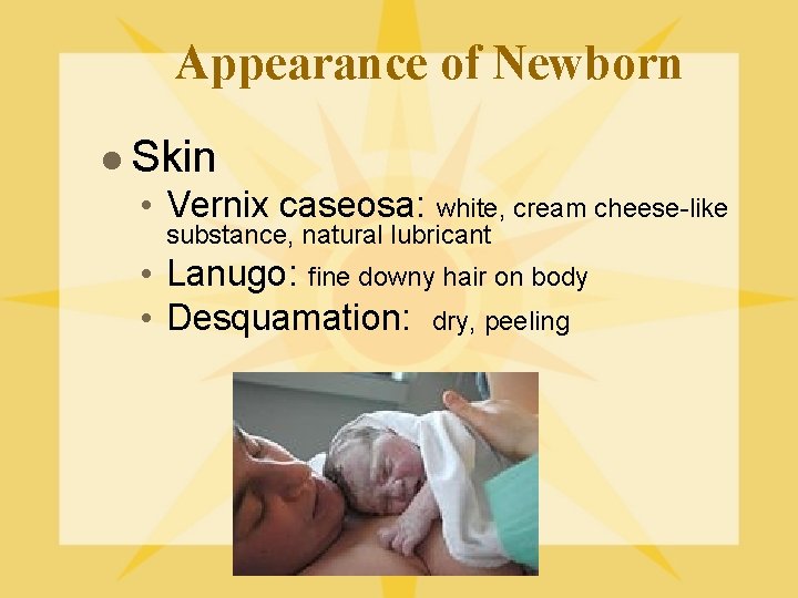 Appearance of Newborn l Skin • Vernix caseosa: white, cream cheese-like substance, natural lubricant